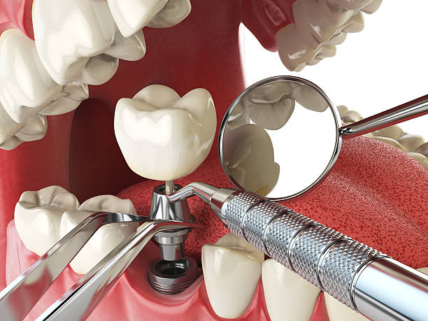 Best Urgent Care for Lost Fillings or Crowns in Lawtey, FL